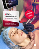 CarbonFrax® CO2 Фракційний лазер CO2