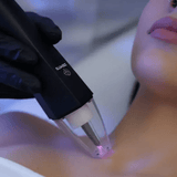 Zemits EvoPlasm Апарат холодної плазми